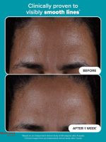 2%-BHA-Liquid-Exfoliant-Before-and-After2