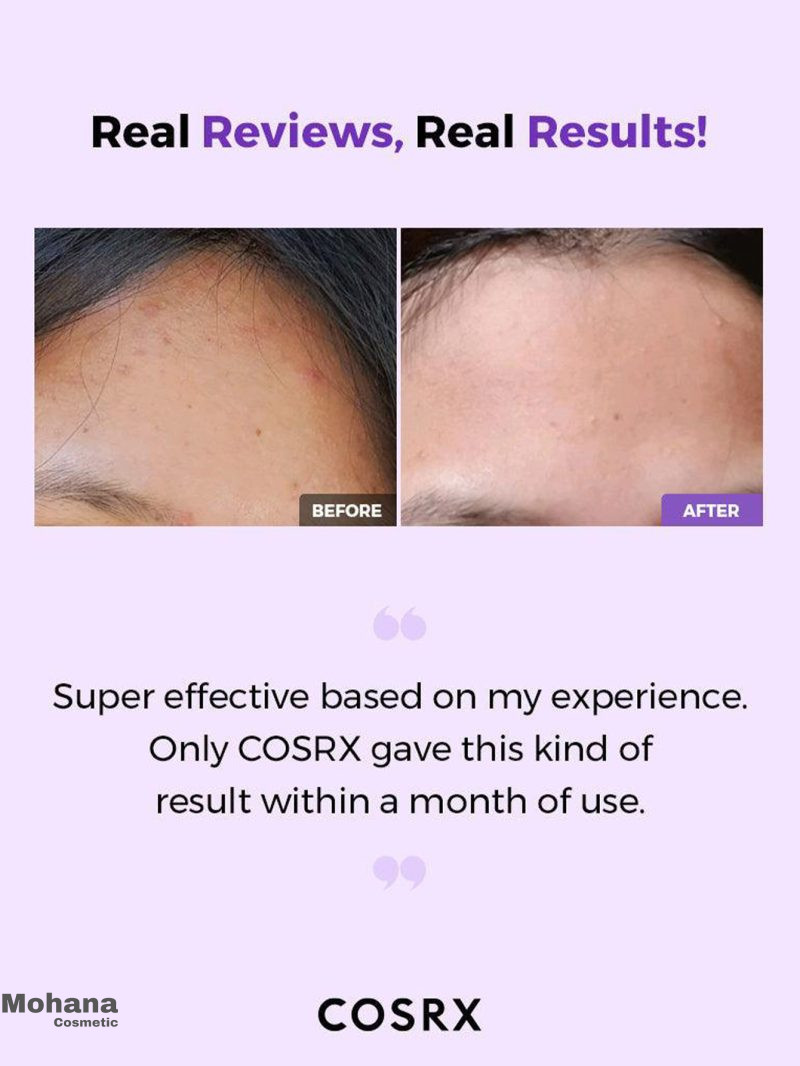 تونر لایه بردار کوزارکس مدل AHA/BHA Clarifying Treatment - Image 4