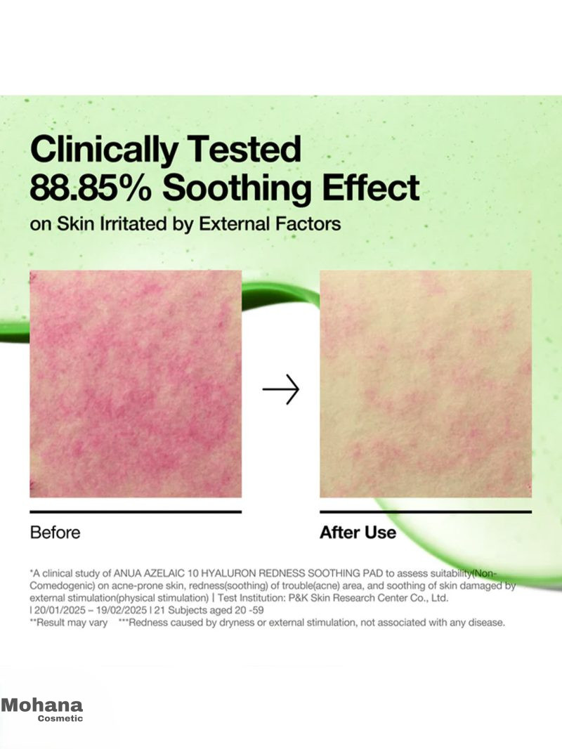 تونر پد آزلائیک اسید و هیالورون آنوا مدل Soothing Pad - Image 4
