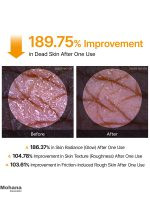 اسپری لایه بردار بدن دکتر ملاکسین مدل Peel Shot Kojic Acid - تصویر 5