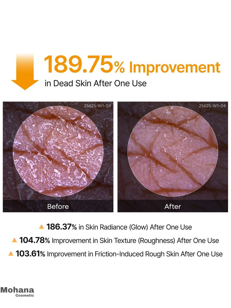 اسپری لایه بردار بدن دکتر ملاکسین مدل Peel Shot Kojic Acid - تصویر 5
