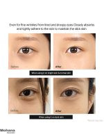 کرم دور چشم کلسیم دکتر ملاکسین مدل Calcium Dark Spot - تصویر 6
