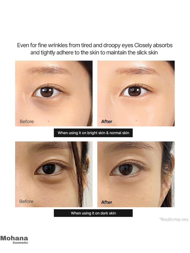 کرم دور چشم کلسیم دکتر ملاکسین مدل Calcium Dark Spot - تصویر 6