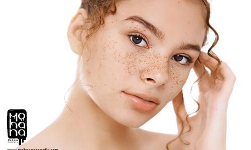 بهترین-ضد-لک-برای-پوست-چرب