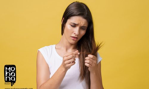 موخوره-چیست؟-علت،-درمان-موخوره-و-روش‌های-جلوگیری-از-موخوره-بدون-کوتاه-کردن-مو